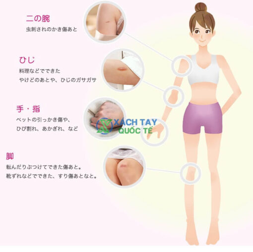 Công dụng của kem trị sẹo Kobayashi Attono Nhật Bản